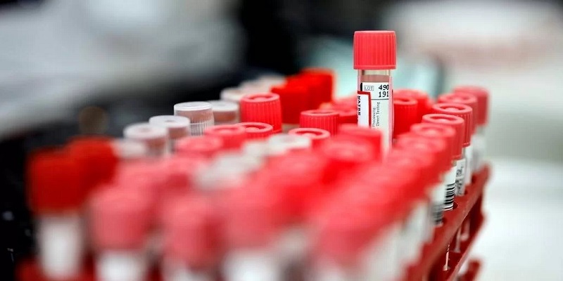 Ir para  <p><big>Um hospital na Calif&oacute;rnia (Estados Unidos) anunciou nesta quarta-feira, 27, que um homem de 66 anos est&aacute; h&aacute; mais de um ano e cinco meses em remiss&atilde;o do HIV, causador da Aids,...
