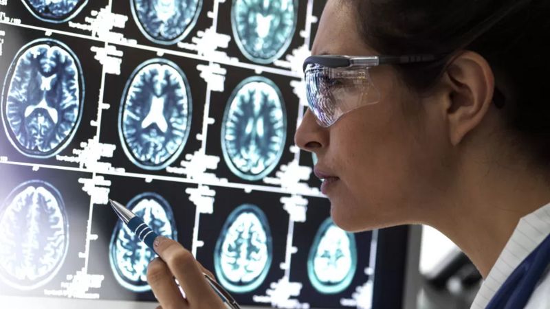 Ir para  <p><big>Cientistas do Reino Unido e da B&eacute;lgica acreditam ter finalmente entendido como as c&eacute;lulas cerebrais morrem na doen&ccedil;a de Alzheimer.</big></p>

<p><big>H&aacute;...